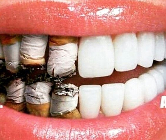 Teeth and cigarettes